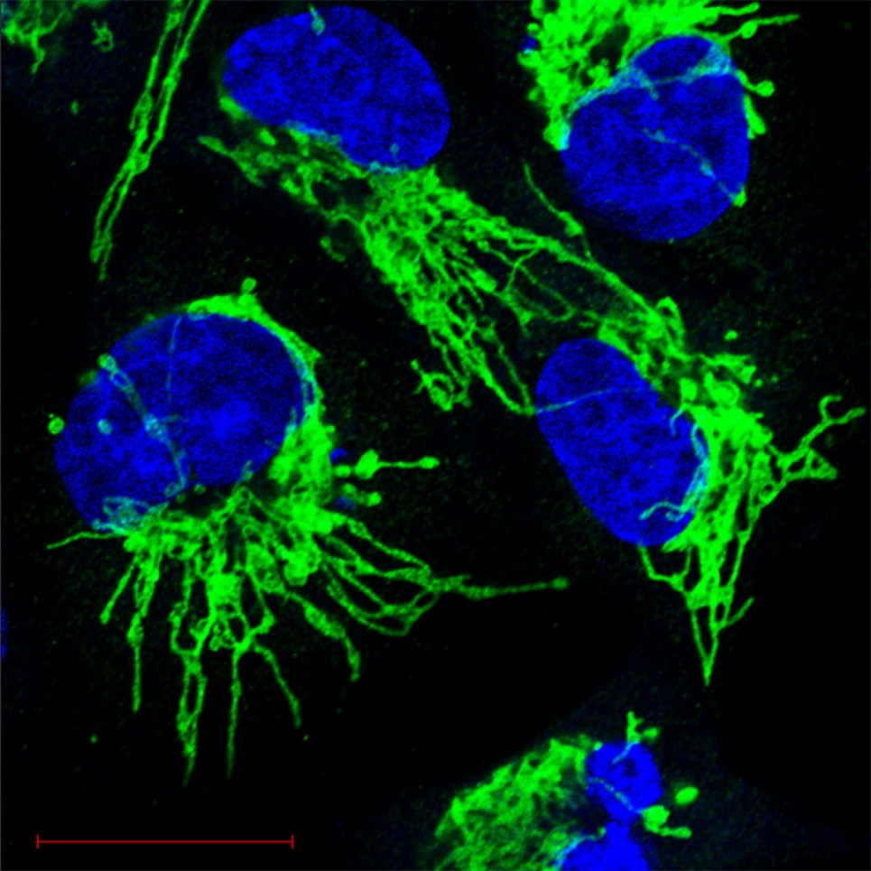 About a third of all human cancers are driven by mutations in RAS genes.