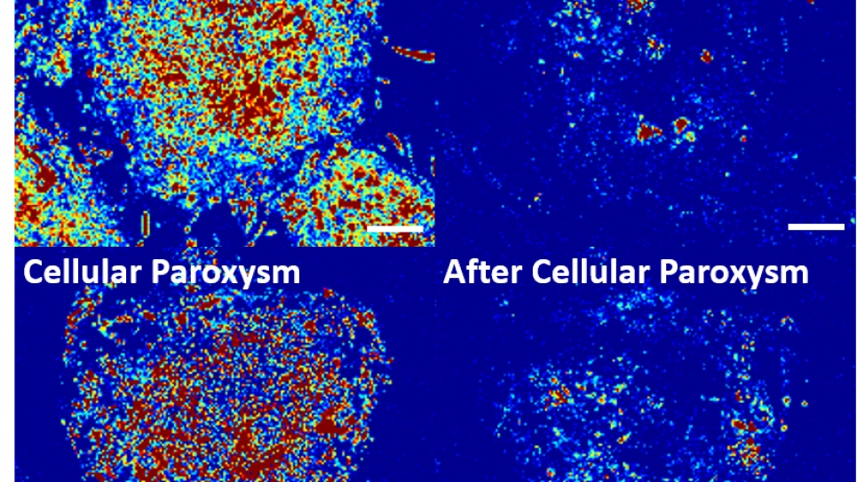 Cellular paroxysm