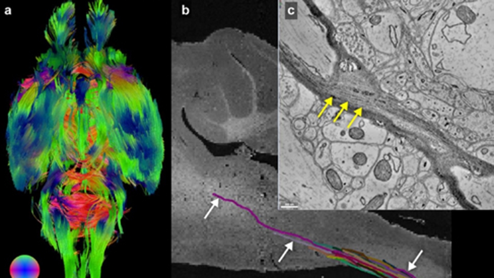 Mouse Brain Imaged from the Microscopic to the Macroscopic Level