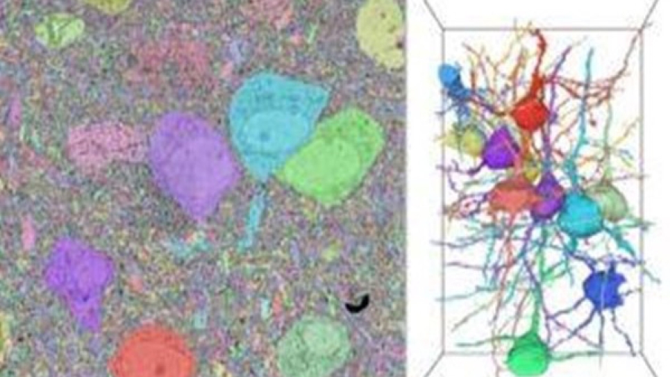 Moving Toward Advances in Brain Mapping Using Exascale Supercomputers ...
